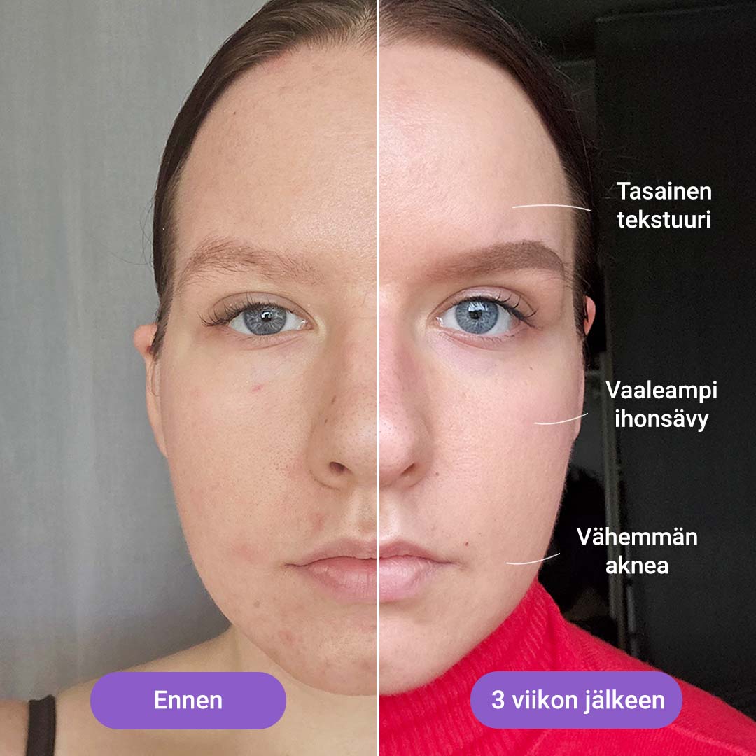 Valohoitonaamio Lumi