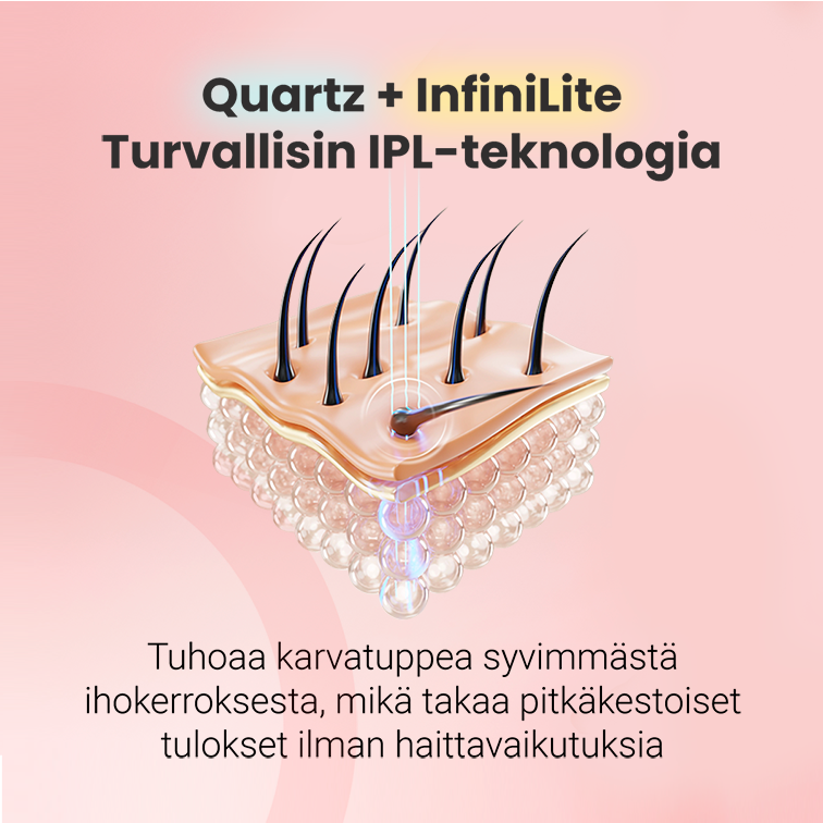 Hilda IPL Quartz -karvanpoistosetti
